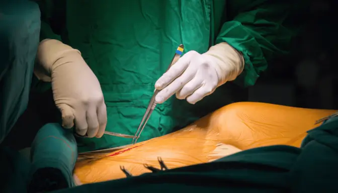 cirurgia-para-isquemia